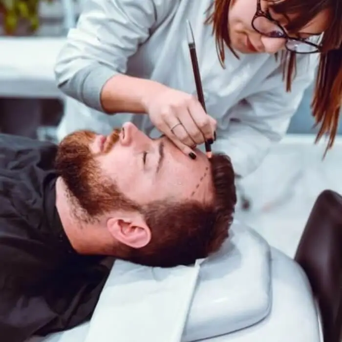 dhi hair transplant