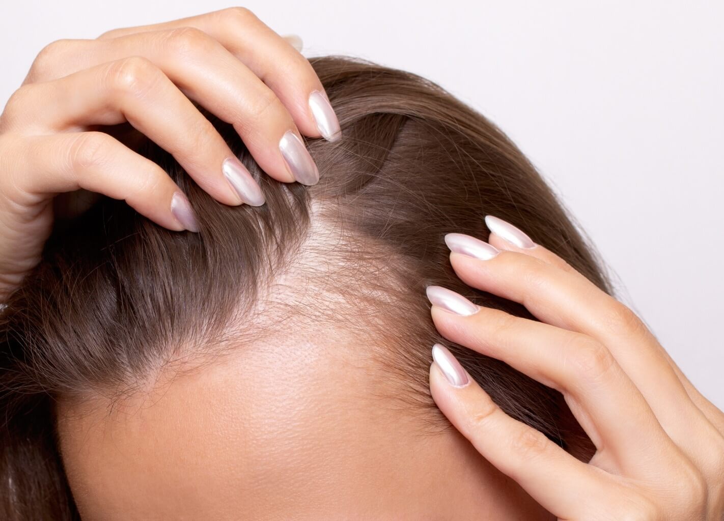Hair Loss and Hair Thinning