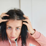 Stress and Hair Loss: Are They Related?