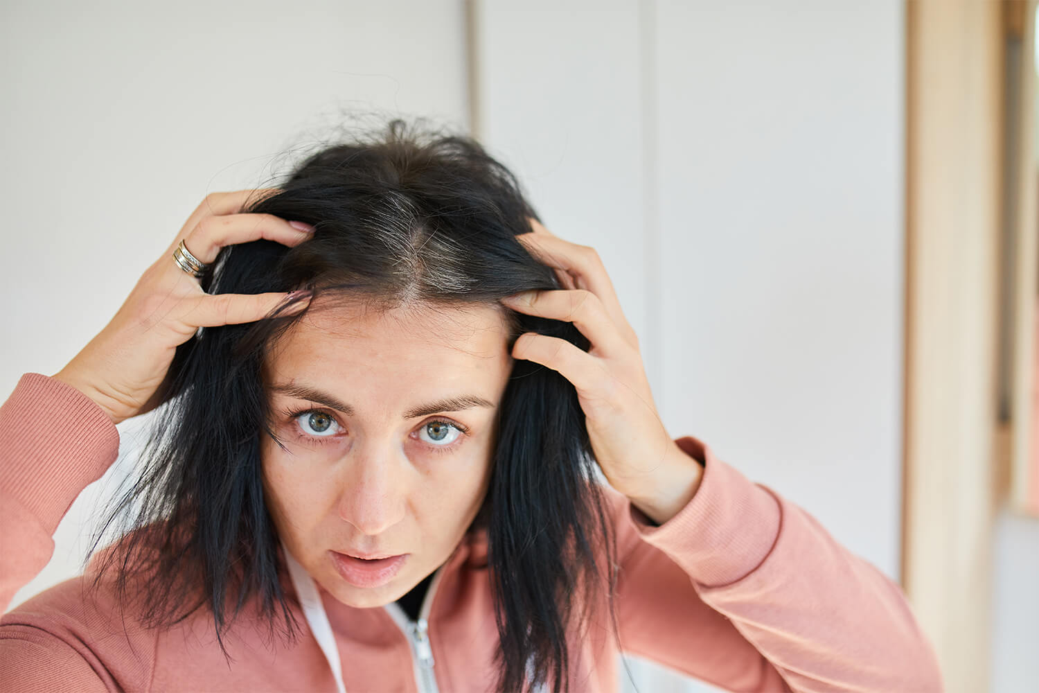 Stress and Hair Loss: Are They Related?