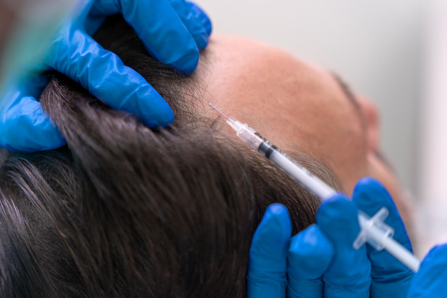 What Is PRP?