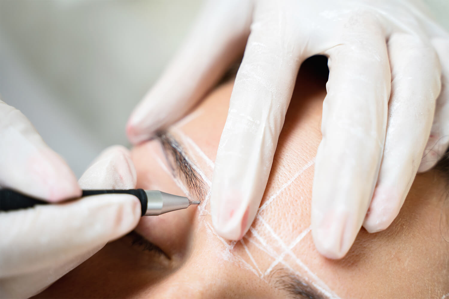 Eyebrow Transplant Turkey