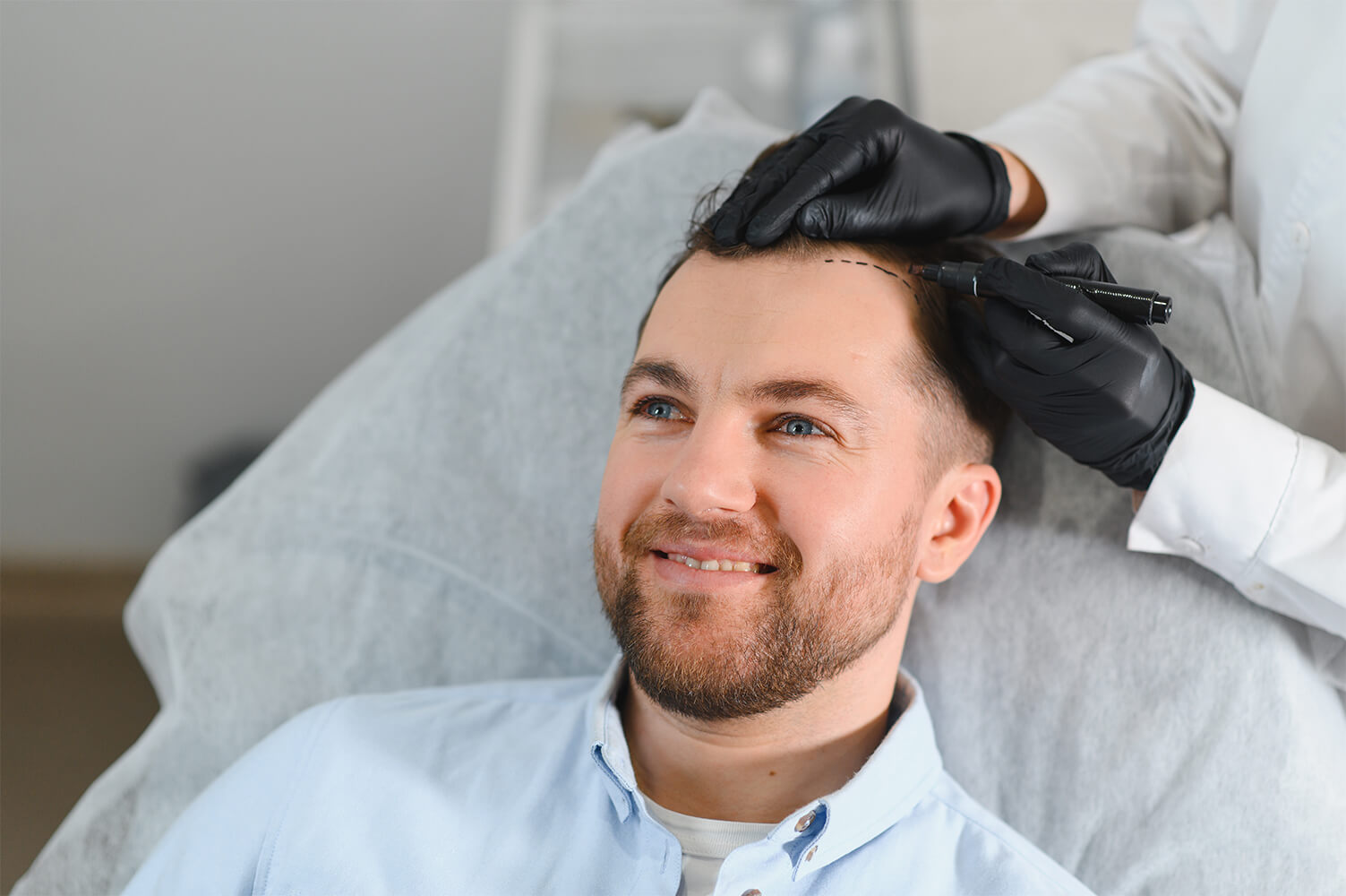 What Should I Do Before Hair Transplant?