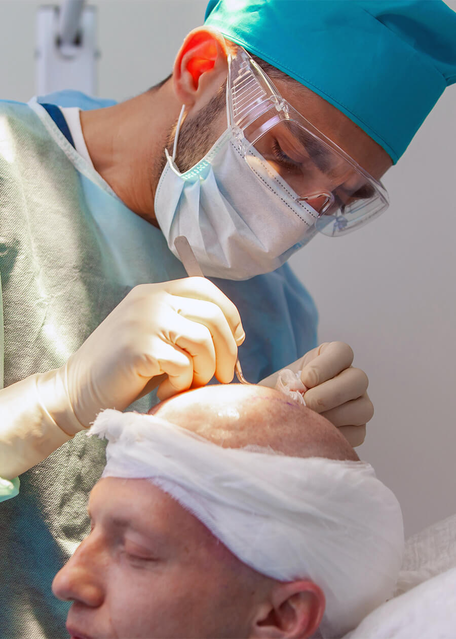 hair transplant turkey