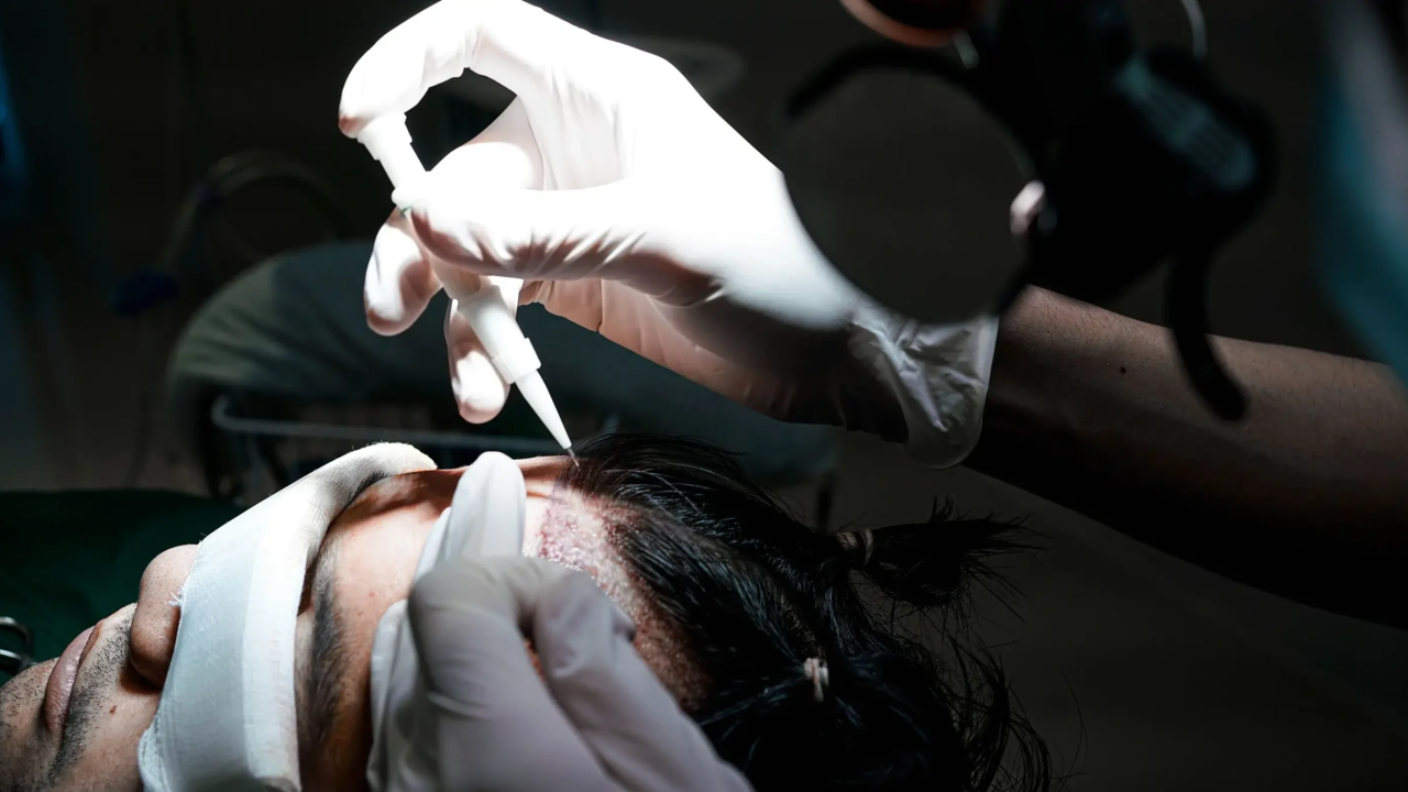 DHI Hair Transplant Turkey